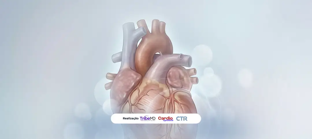 ACC 2026 – STEMI Door to Unload - Descompressão do ventrículo esquerdo em pacientes com infarto agudo do miocárdio com supradesnivelamento do segmento ST (IAMCSST) anterior sem choque