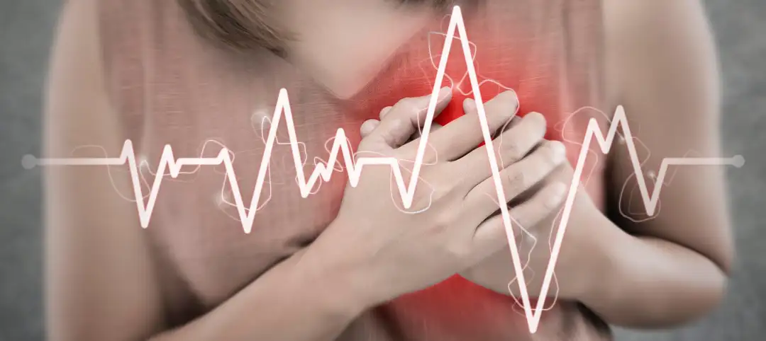 Pós-Graduação em Arritmias Cardíacas